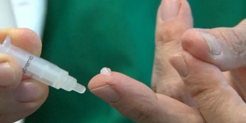 Alprostadil pomada: onde comprar? Alprostadil pomada onde comprar?